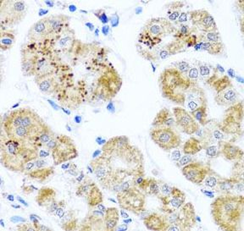 PIP4K2B Antibody
