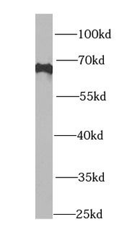PIP5K1A Antibody