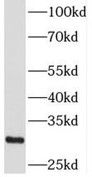 CSDC2 Rabbit Polyclonal Antibody