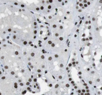 CSDC2 Rabbit Polyclonal Antibody