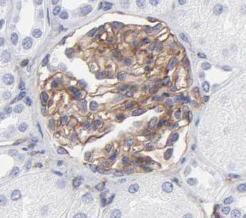 PISD Antibody