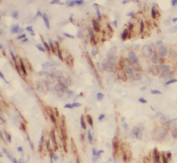 PITPNA Antibody