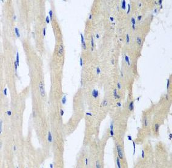 PITRM1 Antibody