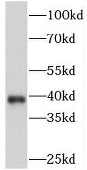 PITX1 Antibody