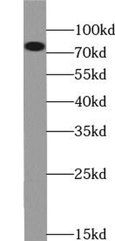 PRKCA Rabbit Polyclonal Antibody
