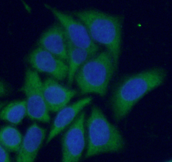PRKCA Rabbit Polyclonal Antibody