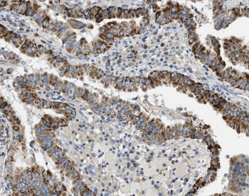 PRKCA Rabbit Polyclonal Antibody
