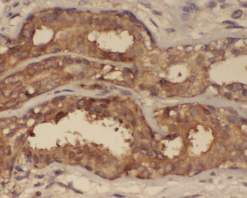PRKCB Rabbit Polyclonal Antibody