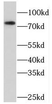PRKCD Rabbit Polyclonal Antibody