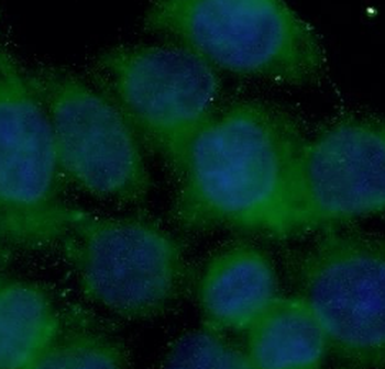 PRKCI Antibody