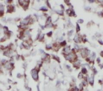 PRKCI Antibody
