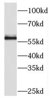 PKM Rabbit Polyclonal Antibody