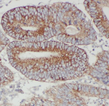 PKM Rabbit Polyclonal Antibody