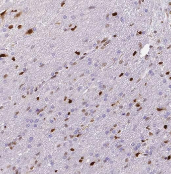 PKNOX1 Antibody