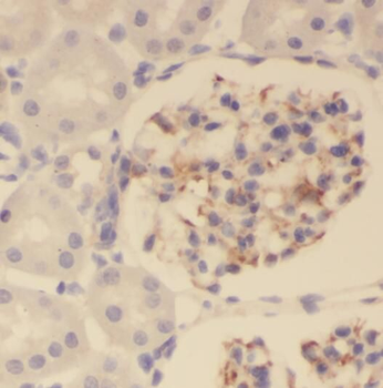 PKNOX2 Antibody