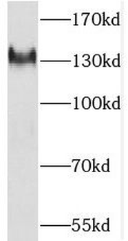 PKP4 Antibody