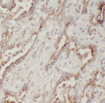 PLA2G12A Antibody