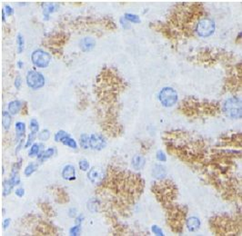 PLA2G1B Antibody