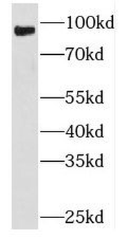 PLA2G4D Antibody