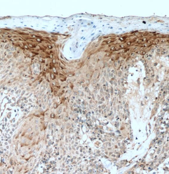 PLA2G4D Antibody