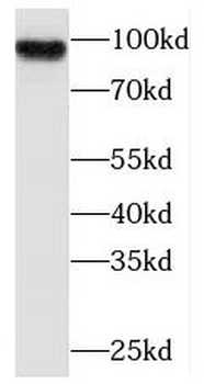 PLA2G4E Antibody