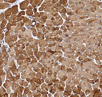 PLA2G4E Antibody