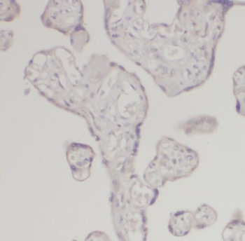 CSH1 Rabbit Polyclonal Antibody