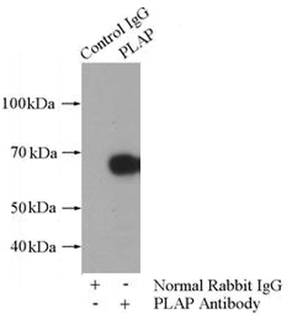 ALPP Antibody