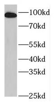 PLG Rabbit Polyclonal Antibody