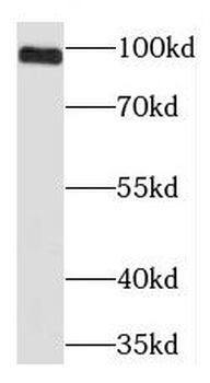 PLG Rabbit Polyclonal Antibody