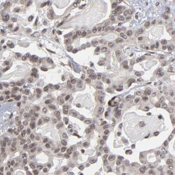 PLCD4 Antibody