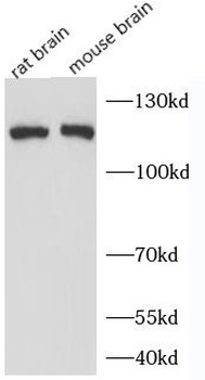 PLCL2 Antibody