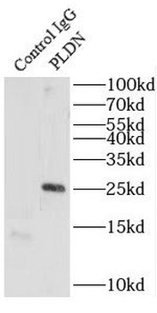 BLOC1S6 Antibody