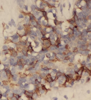 BLOC1S6 Antibody
