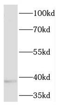 PLEK2 Antibody