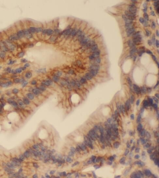 PLEKHA1 Antibody
