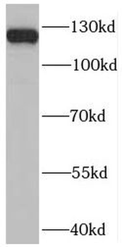 PLEKHH2 Rabbit Polyclonal Antibody