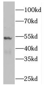 PLEKHO2 Rabbit Polyclonal Antibody