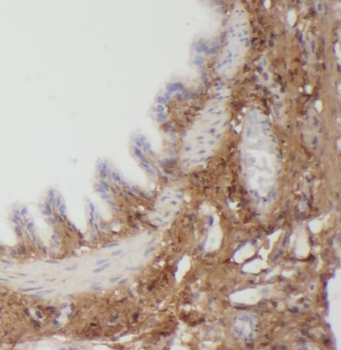 PLEKHO2 Antibody