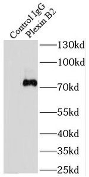 PLXNB2 Antibody