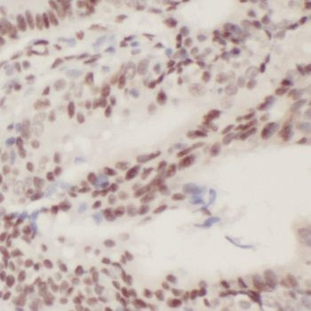 PLK3 Antibody
