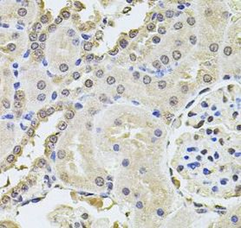 PLK4 Antibody