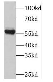 PLK5 Antibody