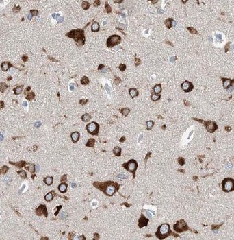 PLK5 Antibody