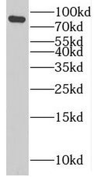 PLOD3 Rabbit Polyclonal Antibody