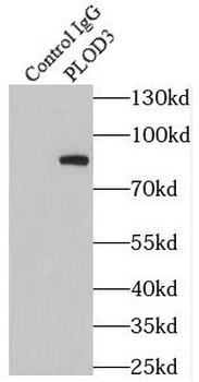 PLOD3 Antibody