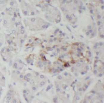 PLOD3 Antibody