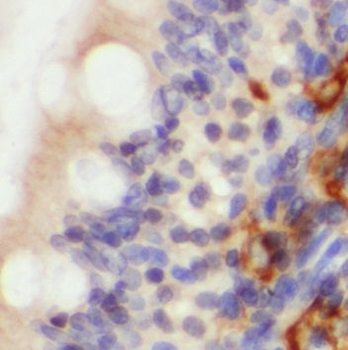 PLP2 Antibody