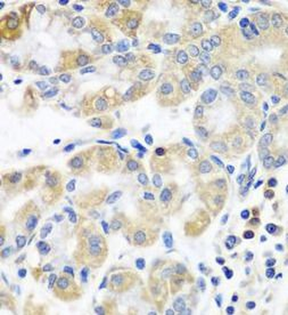 PLS3 Antibody