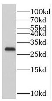 PMM1 Antibody